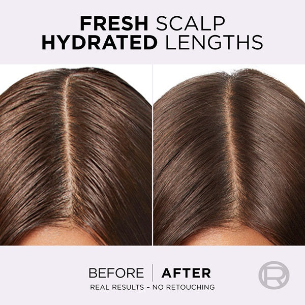 L'Oreal Paris - Elvive Hyaluron Pure Oil Erasing Scalp Serum with Salicylic Acid, for Oily Roots and Dehydrated Lengths
