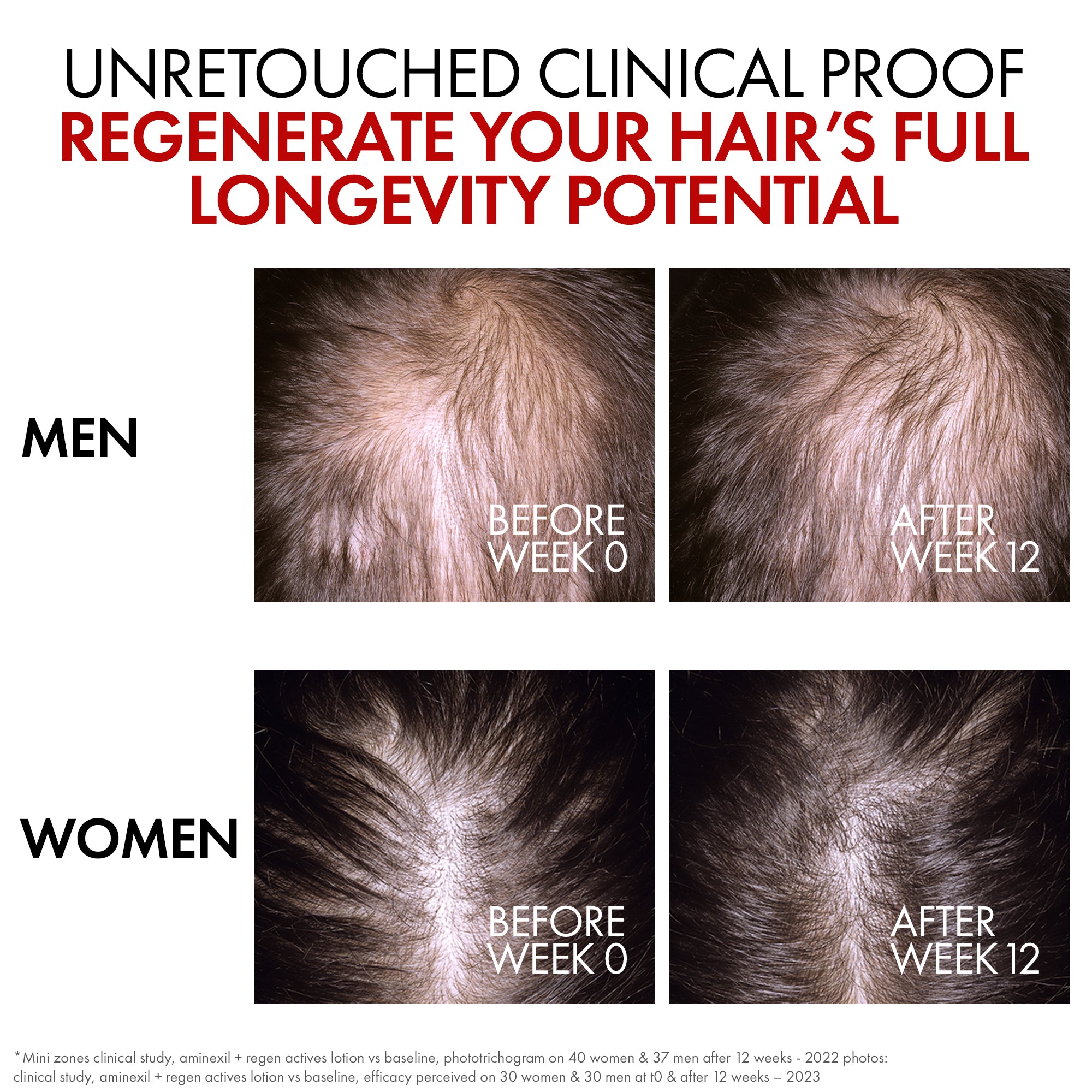 Dercos Aminexil Clinical R.E.G.E.N. Booster 90ml