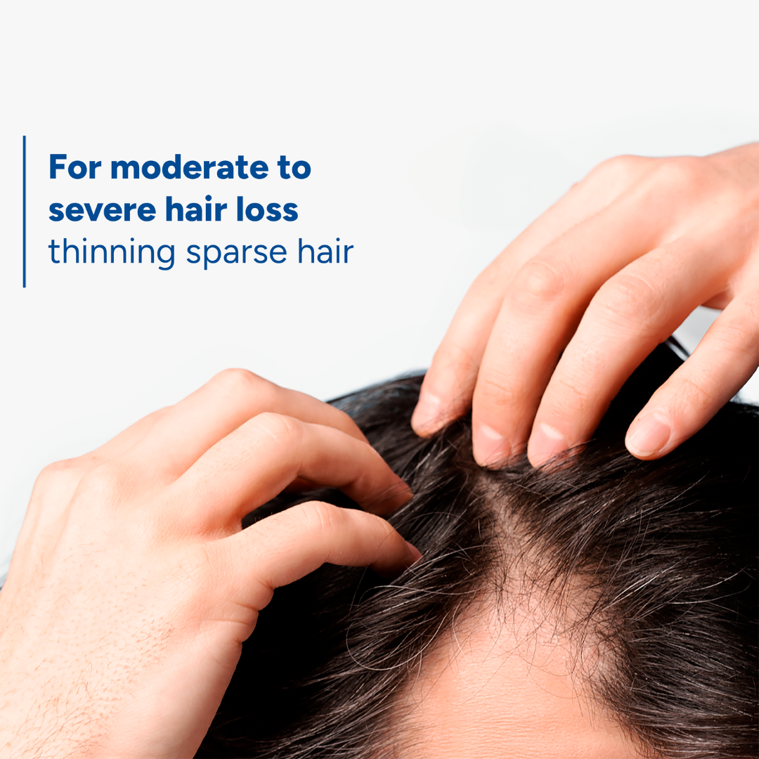 Neoptide Expert Anti-hair loss & growth serum + FREE Anaphase anti-thinning shampoo 100 ml At 25% OFF