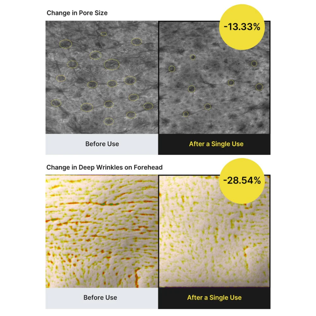 Celimax The Vita A Retinal Shot Tightening Booster 15 ML - Before & After