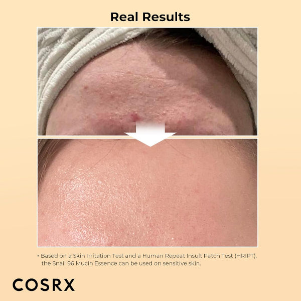 Advanced Snail 96 Mucin Power Essence - Before & After