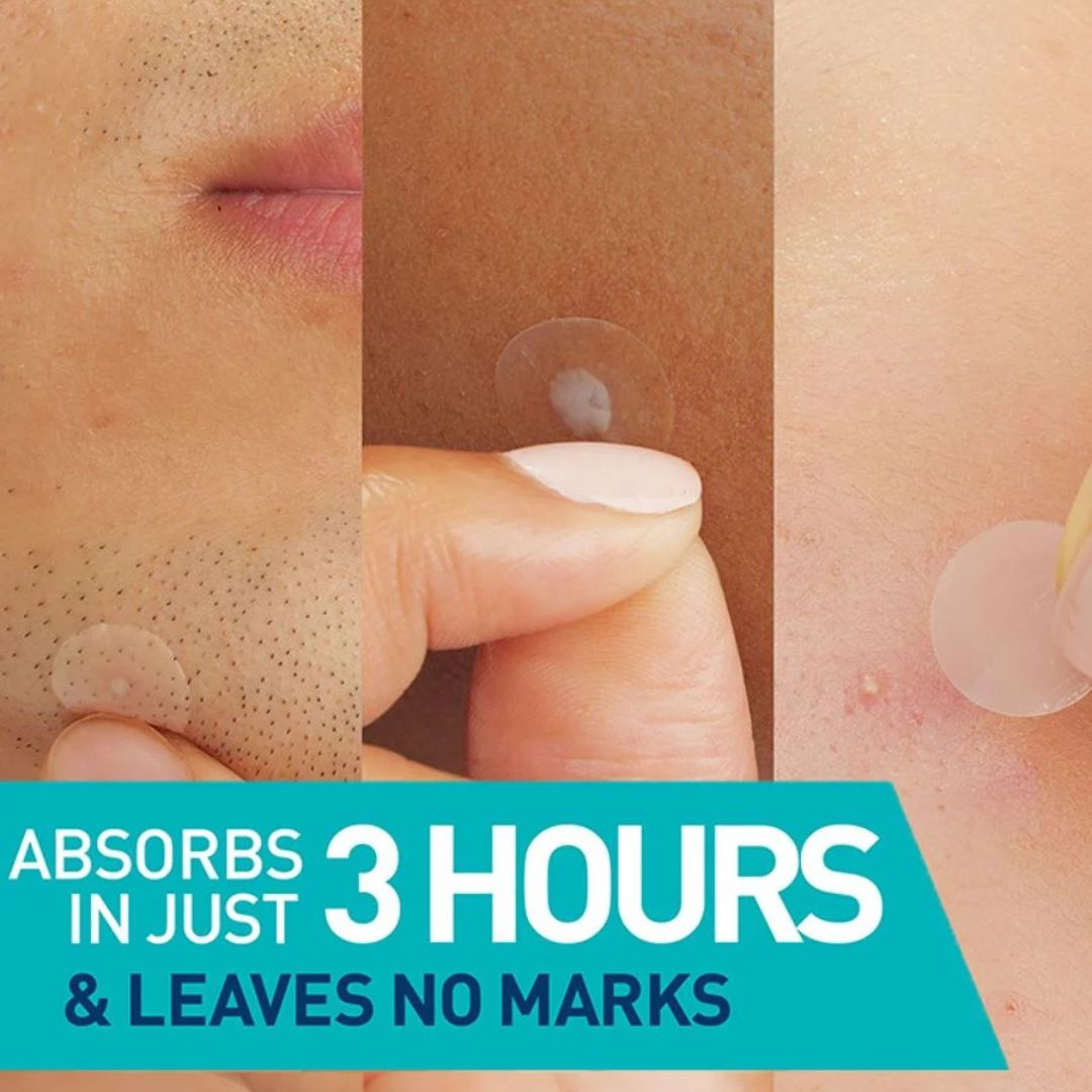 CeraVe Blemish Barrier Patches