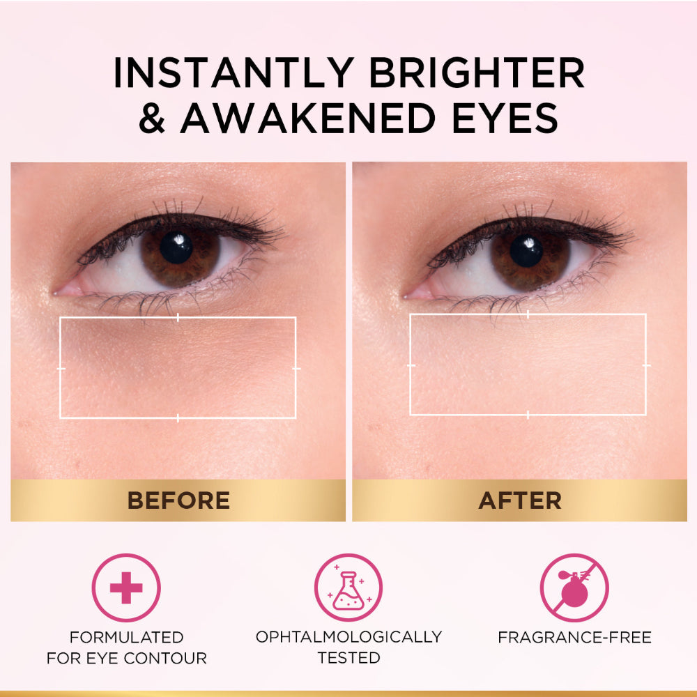 L'Oréal Paris Glycolic [3% Glycolic Acid  + Vitamin CG + Niacinamide] Eye Serum For Dark ircles, Brighten Eyes