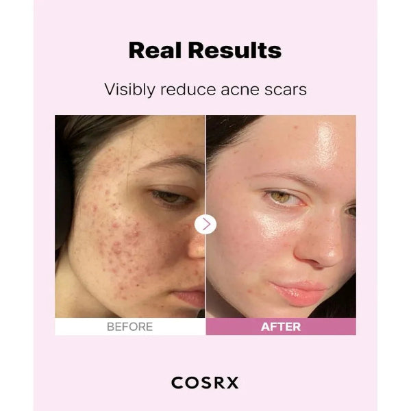 The Niacinamide 15 Serum