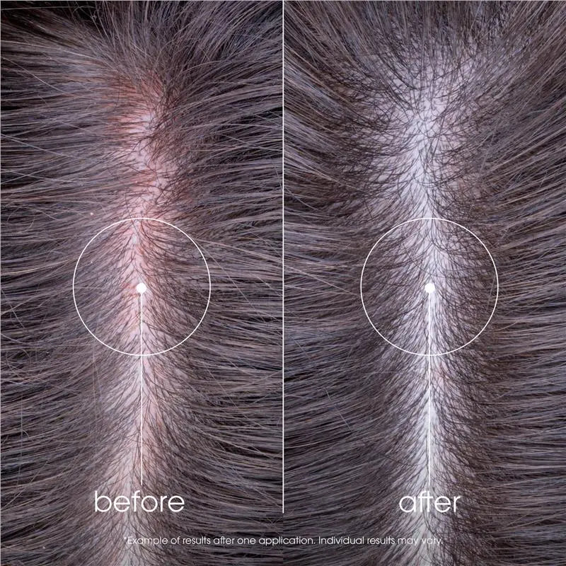 Soothing Peony Shampoo