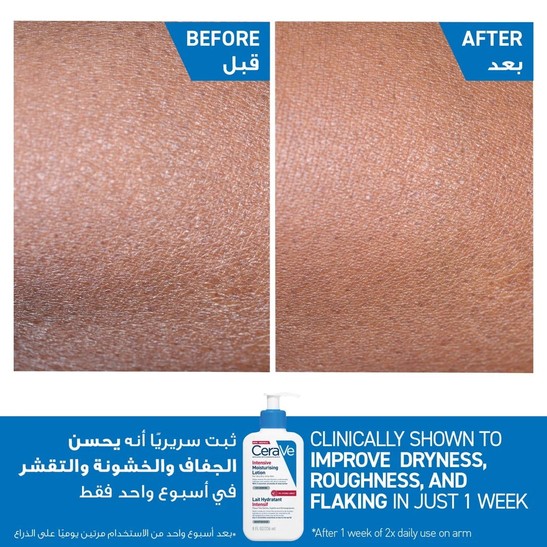 Intensive Moisturising Lotion for Very Dry Skin 236ml